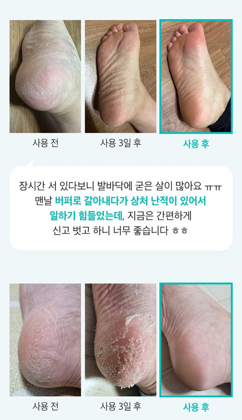 [Ariul] Smooth & Pure Foot Peeling Mask (2 Pairs)